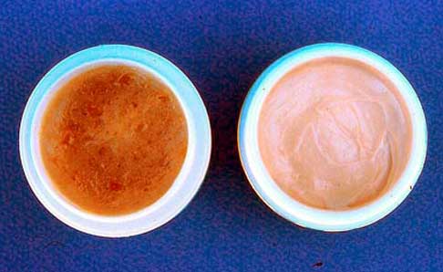 On the left, a vaseline-propolis ointment which was not properly emulsified. Droplets of propolis extract are separating from the vaseline and give the cream a defective appearance. On the right, a well-emulsified cream (o/w) with emulsifier and proper processing, shows no sign of separation after more than one year of storage. 
