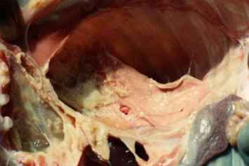 Typical lesions of contagious caprine pleuropneumonia (CCPP) in a goat